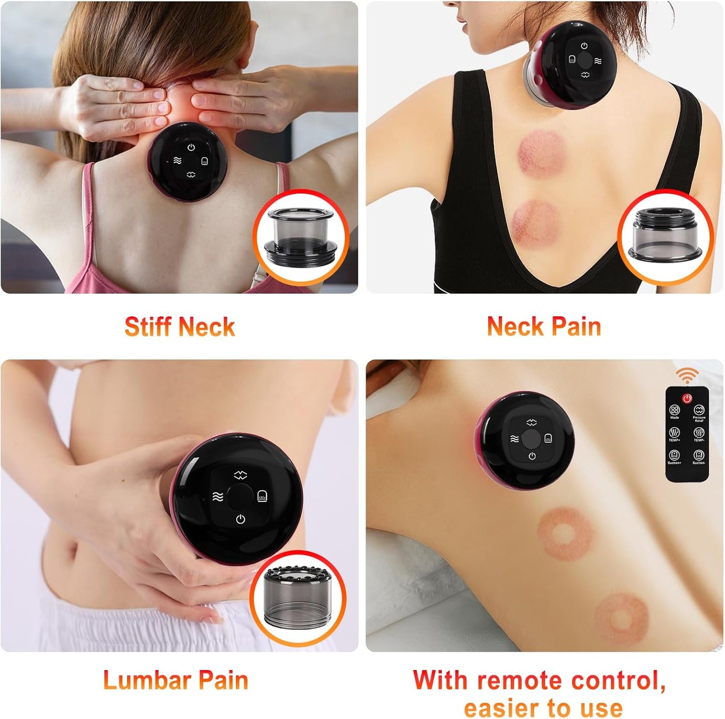 5-in-1 Electric Cupping Set with Red Light Therapy & Remote