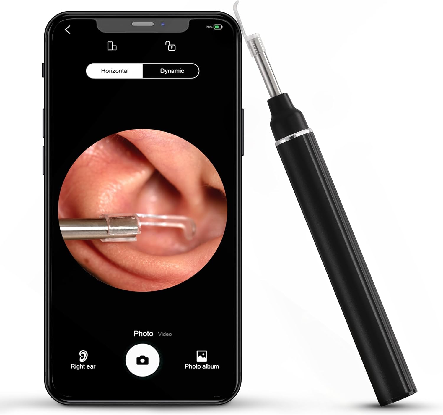 Ear Wax Removal Kit with 1080P Camera – Wireless Otoscope for iPhone & Android