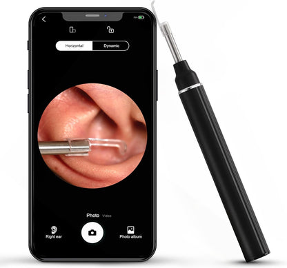 Ear Wax Removal Kit with 1080P Camera – Wireless Otoscope for iPhone & Android