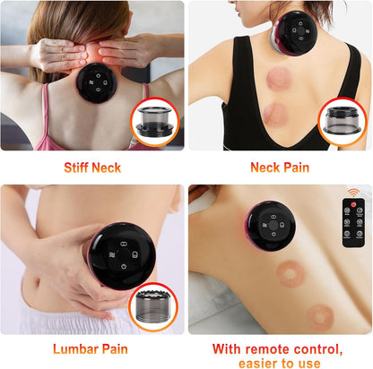 5-in-1 Electric Cupping Set with Red Light Therapy & Remote