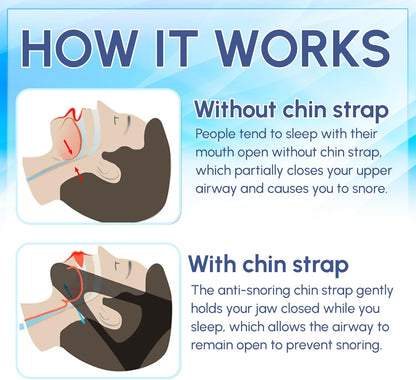 Adjustable Anti Snoring Chin Strap – Breathable CPAP Sleep Aid