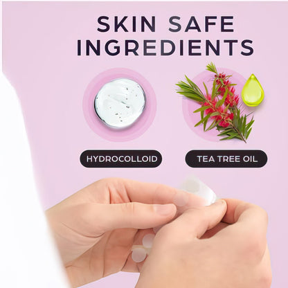 KEYCONCEPTS Acne Patches – 120 Count Hydrocolloid Pimple Patches with Tea Tree Oil