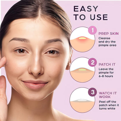 KEYCONCEPTS Acne Patches – 120 Count Hydrocolloid Pimple Patches with Tea Tree Oil