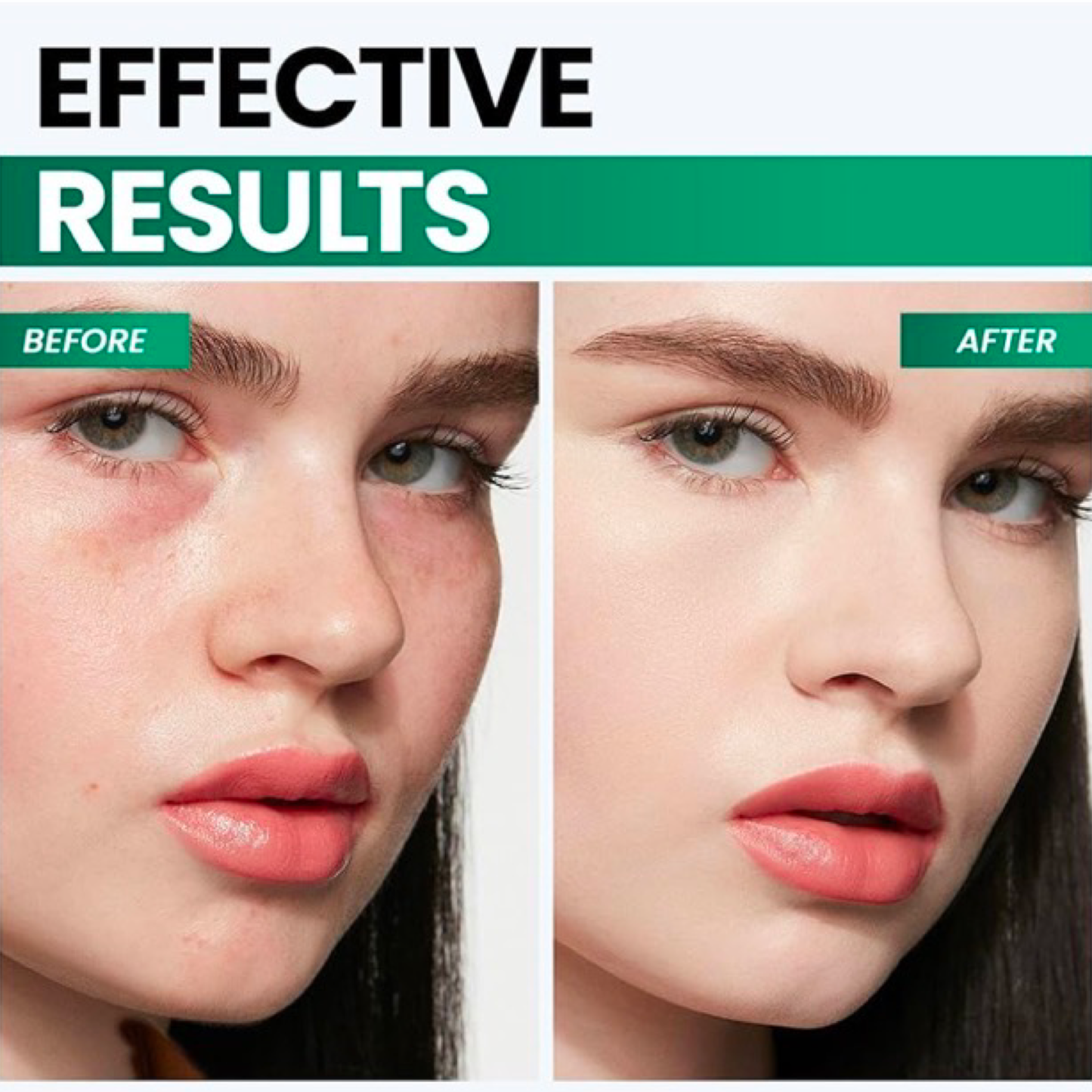 Micro V Face Slimmer Massager w/LED Technology - Promotes Collagen Production