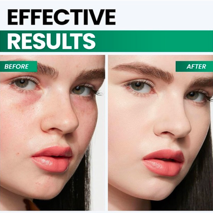 Micro V Face Slimmer Massager w/LED Technology - Promotes Collagen Production